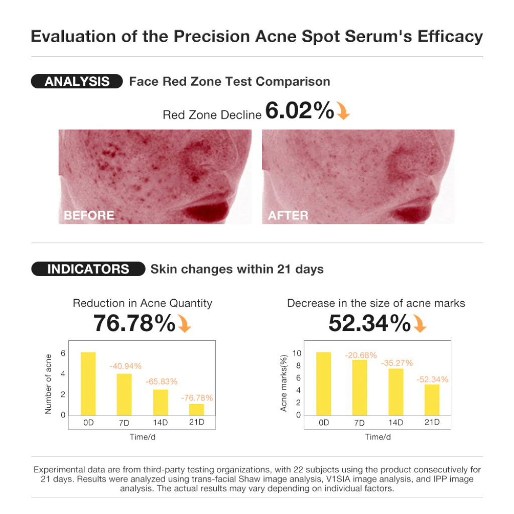 Salicylic Acid Precision Acne Spot Serum - Mink Muse